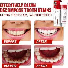 SP-4 Probiotic Intensive Teeth  Whitening Toothpaste    4.9/5 Reviews