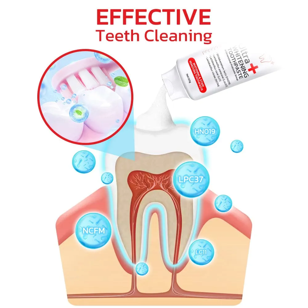 SP-4 Probiotic Intensive Teeth  Whitening Toothpaste    4.9/5 Reviews