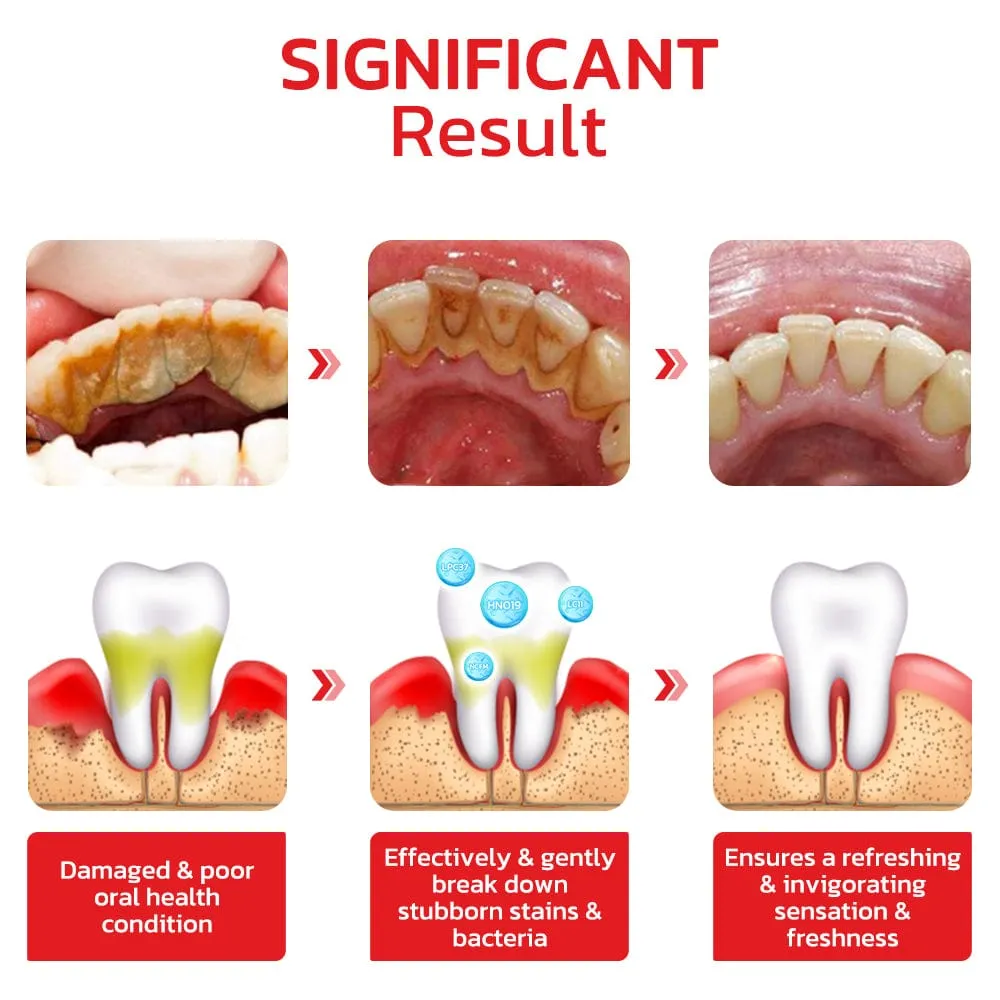 SP-4 Probiotic Intensive Teeth  Whitening Toothpaste    4.9/5 Reviews